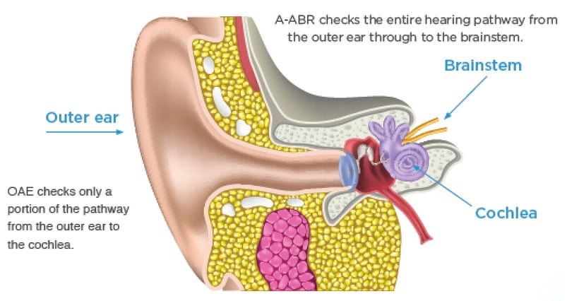 hearing screen blog-new.jpg